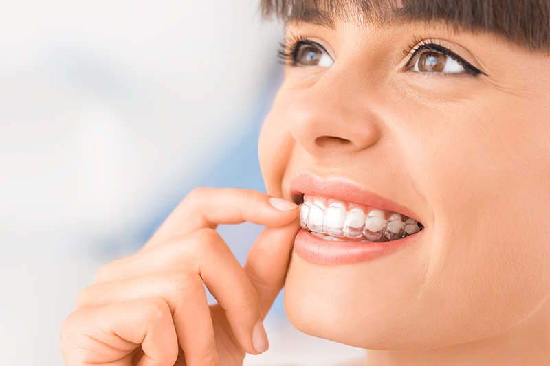 Invisalign in Thorndale